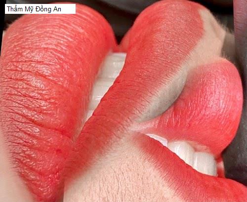 Hình ảnh Thẩm Mỹ Đồng An