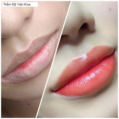 Hình ảnh Thẩm Mỹ Viện Kisa
