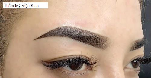 Bảng giá Thẩm Mỹ Viện Kisa