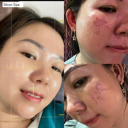 Bảng giá Moon Spa